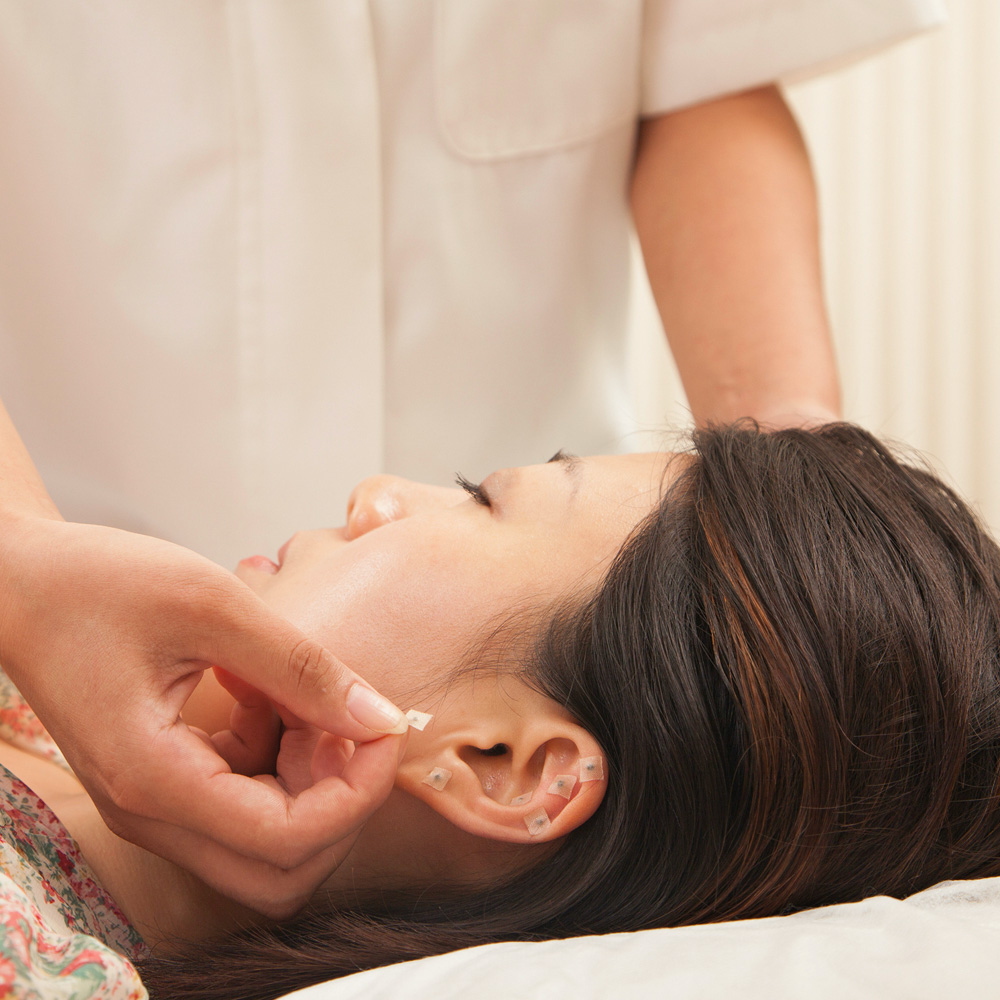 A Refuge acupuncturist placing pins on a patient's earlobe