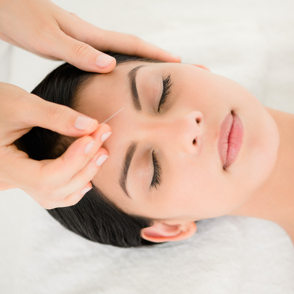 A Refuge acupuncturist placing a needle above the brow of a patient.