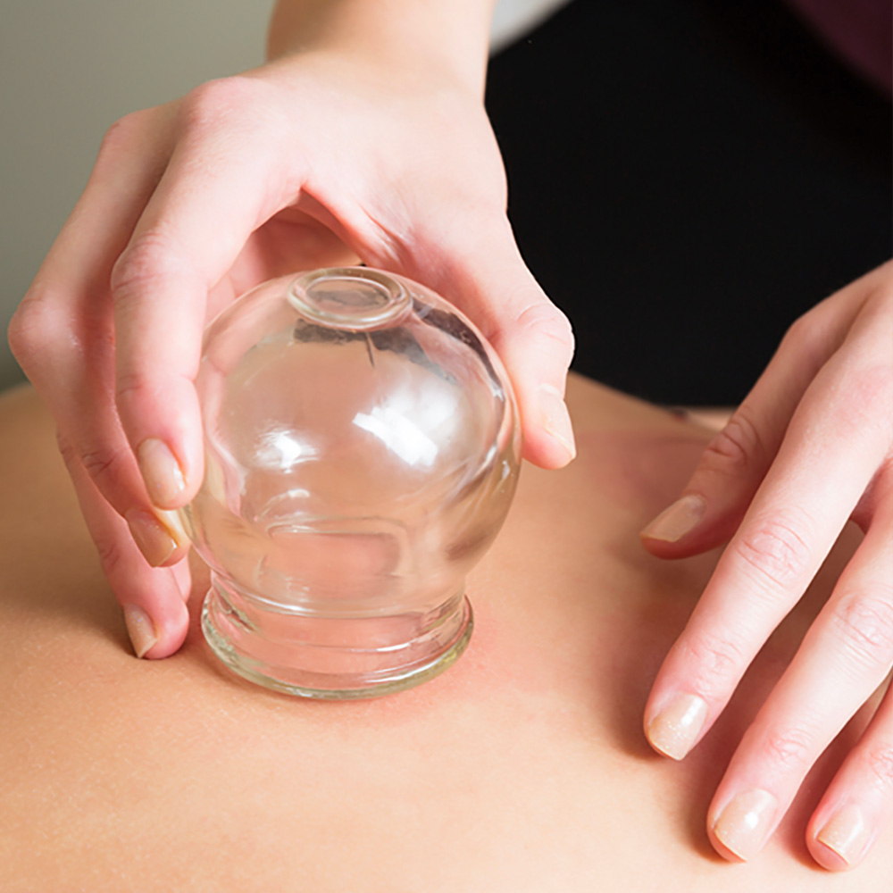 A glass cup being placed on the back of a patient at the Refuge office in Denver